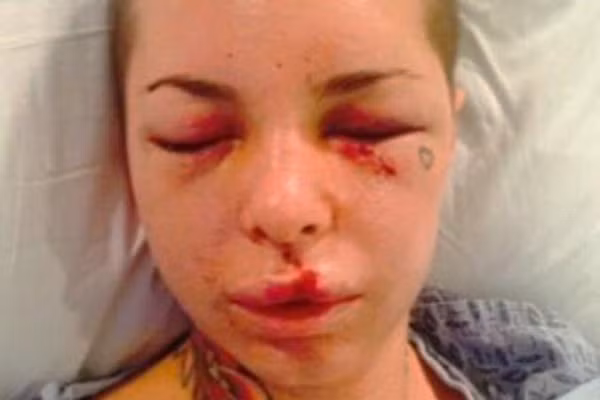 Hãi hùng khi người yêu sao nữ là võ sĩ “côn đồ“