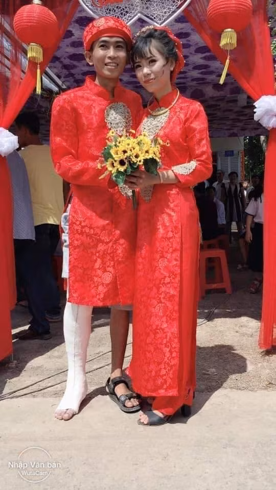 Sự cố tai nạn bị gãy chân khiến chú rể diện trang phục cưới hỏi hơi lạ mắt.