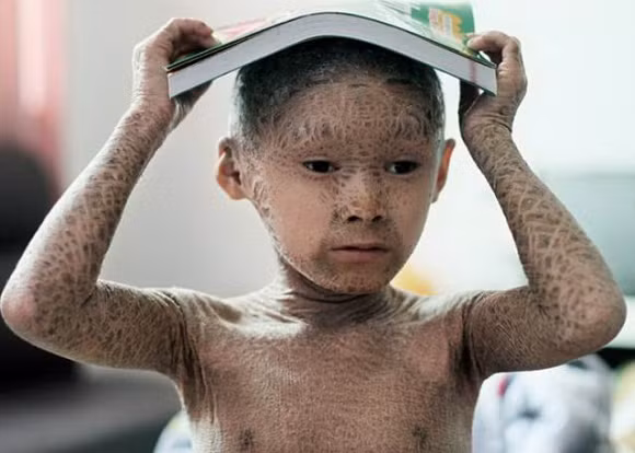 5-ngoisao.vn-w639-h457 5