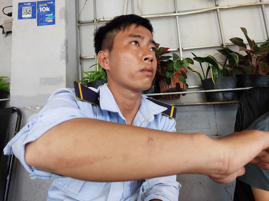 Tay anh Nghĩa bị thương sau khi chống đỡ với nhóm người.