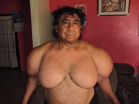 Thợ lặn biến dạng cơ thể sau tai nạn kinh hoàng dưới đáy biển sâu