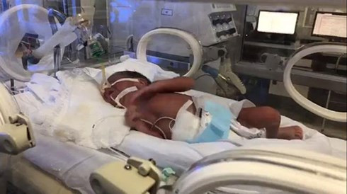 Bà mẹ ung thư giai đoạn cuối vẫn sinh con: Nhìn thấy ảnh con không kìm được nước mắt ảnh 1 Bà mẹ ung thư giai đoạn cuối vẫn sinh con: Nhìn thấy ảnh con không kìm được nước mắt ảnh 1