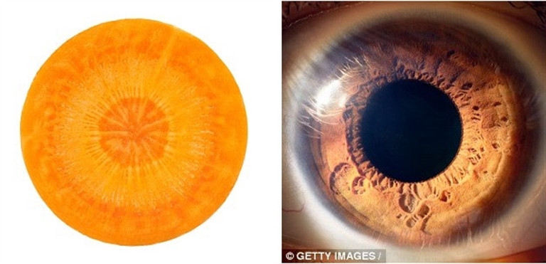 ‘Ăn gì bổ nấy’ với 13 loại thực phẩm này ‘An gi bo nay’ voi 13 loai thuc pham nay