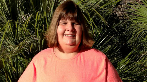 Hannah Wilkinson bị mắc hội chứngPrader-Willi, thiếu hụt một nhiễm sắc thể nên cô bé luônđói. Người mang hội chứng này không thể phẫu thuật như bệnh nhân bị béo phì thông thường. HT-hannah-wilkinson-jef-140814-5264-5468