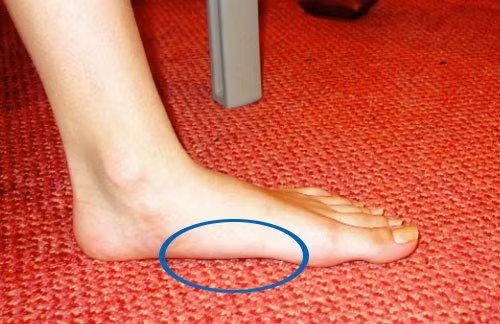 Bestie ban chan phang