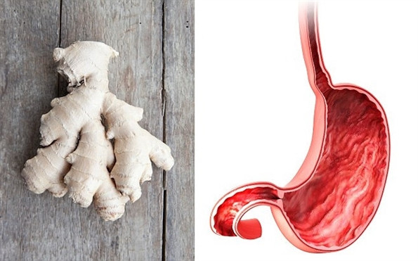 ‘Ăn gì bổ nấy’ với 13 loại thực phẩm này ‘An gi bo nay’ voi 13 loai thuc pham nay