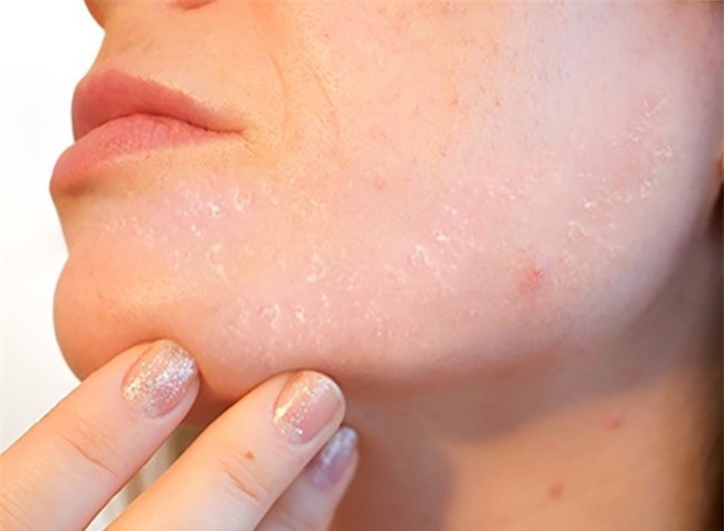 8 dau hieu suc khoe nhieu nguoi thuong phot lo nhung cuc ky nguy hai-Hinh-6