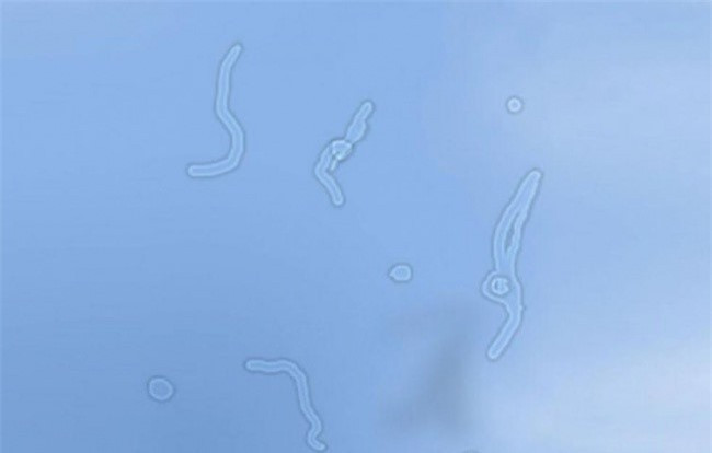 8 dau hieu suc khoe nhieu nguoi thuong phot lo nhung cuc ky nguy hai-Hinh-4