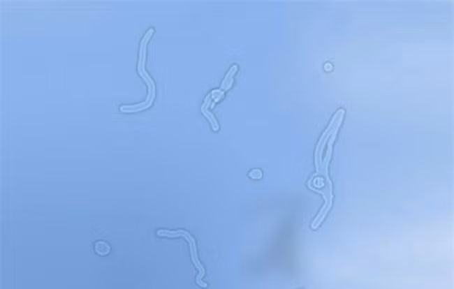 8 dau hieu suc khoe nhieu nguoi thuong phot lo nhung cuc ky nguy hai-Hinh-4