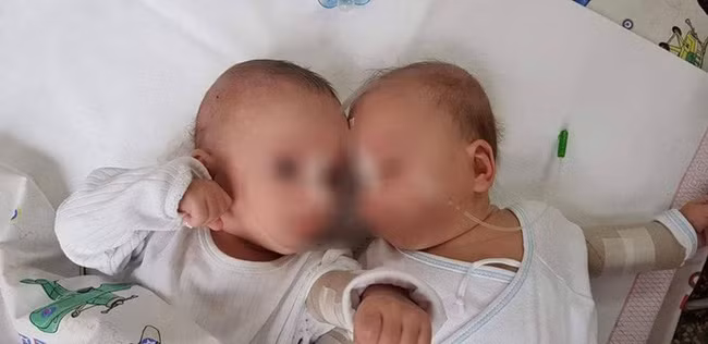 Bức hình cặp song sinh 5 tháng tuổi bị trói chặt trên giường bệnh và sự thật gây sốc khiến ai cũng phẫn nộ - Ảnh 1.