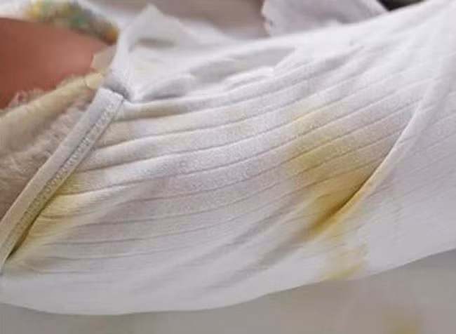 Bức hình cặp song sinh 5 tháng tuổi bị trói chặt trên giường bệnh và sự thật gây sốc khiến ai cũng phẫn nộ - Ảnh 3.