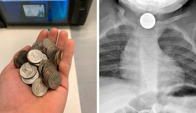 10 vật dụng quen thuộc trong nhà nhưng dễ gây nguy hiểm tính mạng trẻ nhỏ ảnh 8