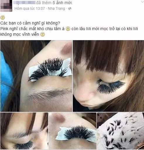 loat anh ron ca nguoi khien chi em rung minh: xem xong con ai dam di noi mi? - 3