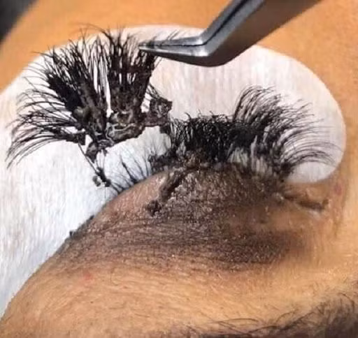 loat anh ron ca nguoi khien chi em rung minh: xem xong con ai dam di noi mi? - 2