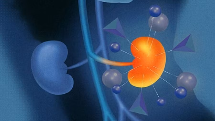 Chế độ ăn nhiều muối dẫn đến tình trạng quá tải chất lỏng, gây độc cho tim, hệ thống mạch máu và thận. (Ảnh: ITN)