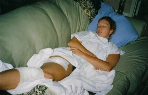 Lisa sau ca phẫu thuật đầu tiên. Ảnh: NVCC.