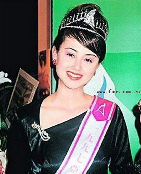 Hoa hậu châu Á ATV Hàn Quân Đình từng nổi tiếng bởi vẻ đẹp lai gợi cảm, cô xuất hiện trong nhiều bộ phim truyền hình thập niên 90 và được khán giả yêu quý. Tuy nhiên, khoảng năm 2010, cô "mất tích" khỏi làng giải trí, sau đó trở lại với diện mạo nhiều thay đổi, đặc biệt là chiếc mũi lệch. Giải thích về sự khác biệt ngoại hình, Hàn Quân Đình cho biết cô khác xưa vì bị tai nạn, tuy nhiên khán giả cho rằng cô đã phẫu thuật thẩm mỹ hỏng. Hoa hậu châu Á ATV Hàn Quân Đình từng nổi tiếng bởi vẻ đẹp lai gợi cảm, cô xuất hiện trong nhiều bộ phim truyền hình thập niên 90 và được khán giả yêu quý. Tuy nhiên, khoảng năm 2000, cô mất tích khỏi làng giải trí, sau đó trở lại với diện mạo nhiều thay đổi, đặc biệt là chiếc mũi lệch. Giải thích về sự khác biệt ngoại hình, Hàn Quân Đình cho biết cô khác xưa vì bị tai nạn.