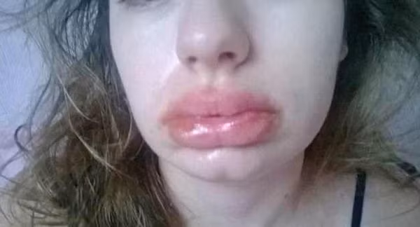 bệnh lạ,dị ứng bệnh lạ,dị ứng