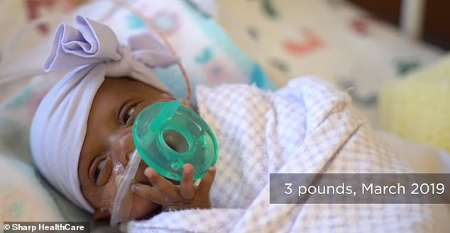 Bé gái tí hon chỉ bằng quả táo, đặt gọn trong bàn tay bác sĩ Bé gái tí hon chỉ bằng quả táo, đặt gọn trong bàn tay bác sĩ