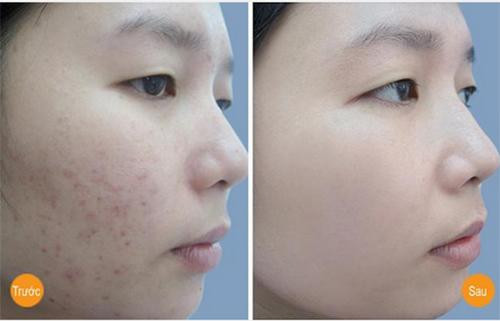 chi voi 1 qua chuoi ban day ngoai cho, ban tre ra ca chuc tuoi voi cong thuc nay - 6