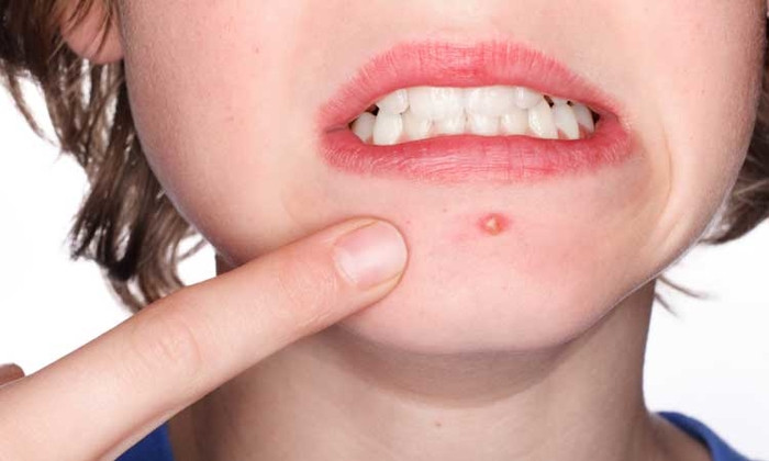 Tưởng là đồ bỏ đi, nhưng bã cà phê và loạt nguyên liệu sau lại có tác dụng làm đẹp “thần thánh” ảnh 15 Tưởng là đồ bỏ đi, nhưng 4 nguyên liệu sau lại có tác dụng làm đẹp