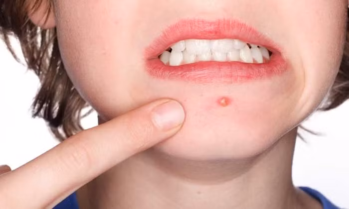 Tưởng là đồ bỏ đi, nhưng 4 nguyên liệu sau lại có tác dụng làm đẹp