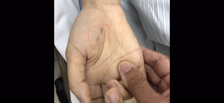 Sức khỏe - Bác sĩ thú y thiệt mạng vì bị chó dại cắn