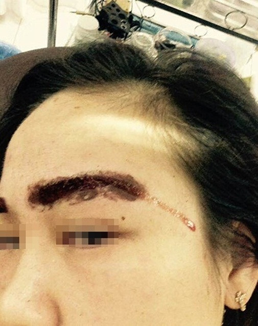 Tai nạn thẩm mỹ có 1-0-2 ảnh 5 lam-dep-blogtamsuvn.jpg 3