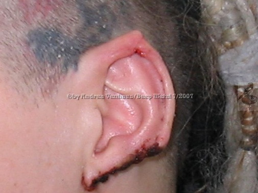 Tai nạn thẩm mỹ có 1-0-2 ảnh 8 lam-dep-blogtamsuvn.jpg 6