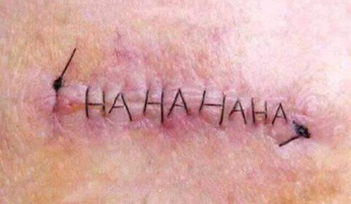 Tai nạn thẩm mỹ có 1-0-2 ảnh 9 lam-dep-blogtamsuvn.jpg 7