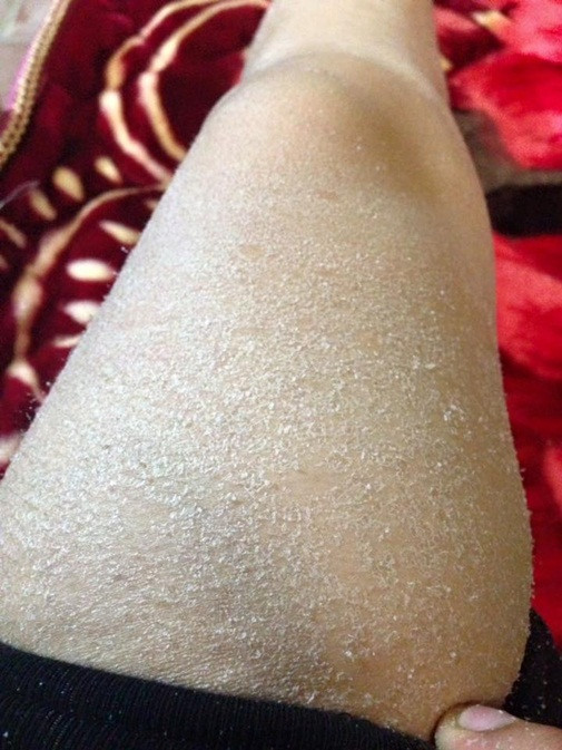 Tai nạn thẩm mỹ có 1-0-2 ảnh 10 lam-dep-blogtamsuvn.jpg 8