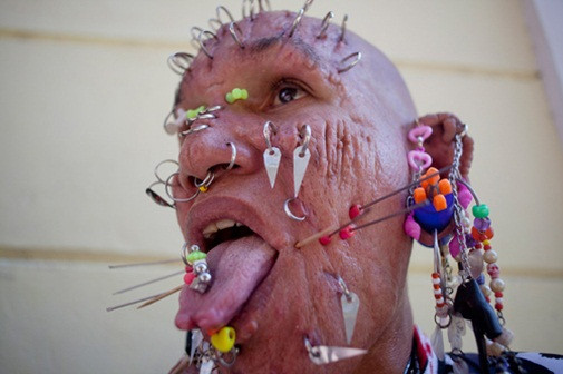 Tai nạn thẩm mỹ có 1-0-2 ảnh 6 lam-dep-blogtamsuvn.jpg 4