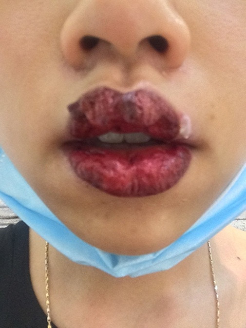 Tai nạn thẩm mỹ có 1-0-2 ảnh 3 lam-dep-blogtamsuvn.jpg 1