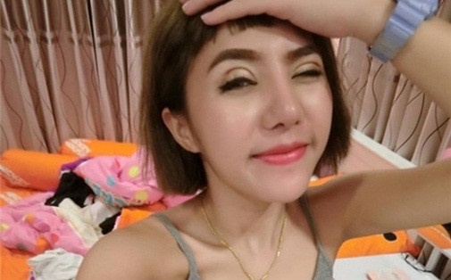 Tai nạn thẩm mỹ có 1-0-2 ảnh 1 lam-dep-blogtamsuvn