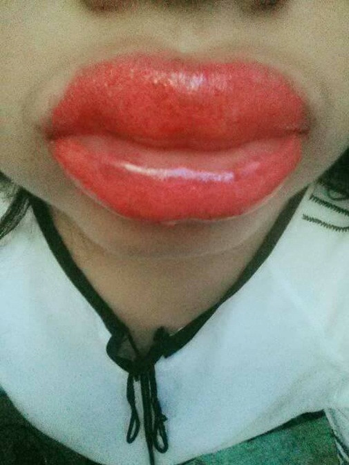 Tai nạn thẩm mỹ có 1-0-2 ảnh 11 lam-dep-blogtamsuvn.jpg 10