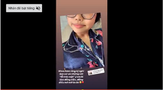 Bị cho là chưa đủ 18 tuổi để giải phẫu thẩm mỹ, Phương Mỹ Chi phản ứng thế nào? ảnh 2 Bị cho là chưa đủ 18 tuổi để giải phẫu thẩm mỹ, Phương Mỹ Chi phản ứng thế nào? ảnh 2