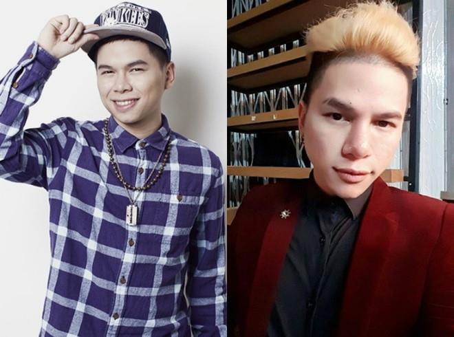 Tranh cãi khi loạt sao nam Việt công khai phẫu thuật thẩm mỹ ảnh 13 Sao nam Việt nhận ý kiến trái chiều khi công khai phẫu thuật thẩm mỹ-13