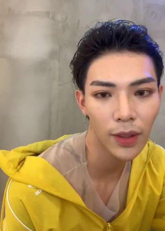 Tranh cãi khi loạt sao nam Việt công khai phẫu thuật thẩm mỹ ảnh 10 Sao nam Việt nhận ý kiến trái chiều khi công khai phẫu thuật thẩm mỹ-10