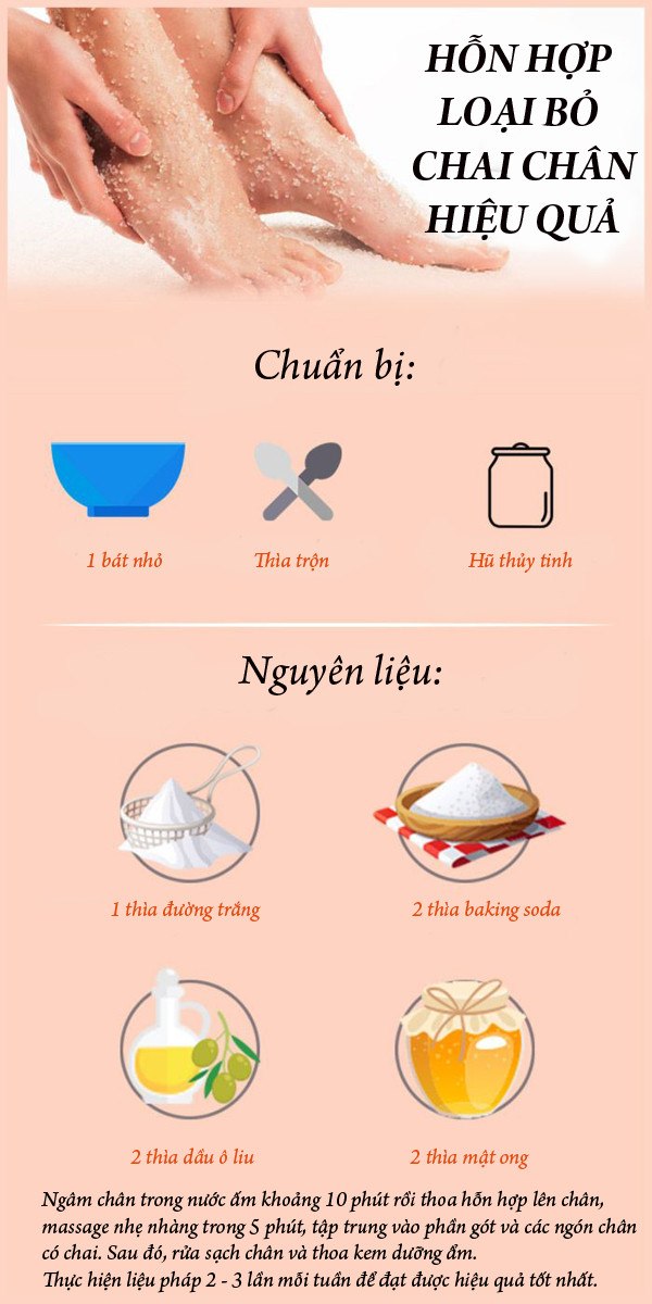 Loại bỏ hoàn toàn chai chân với hỗn hợp bốn thành phần tự chế
