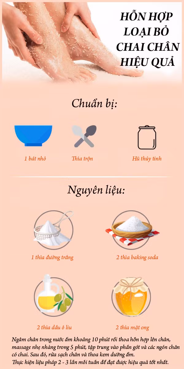 Loại bỏ hoàn toàn chai chân với hỗn hợp bốn thành phần tự chế