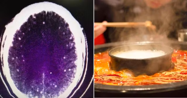 Người đàn ông đã bị nhiễm sán vì lý do không ngờ.