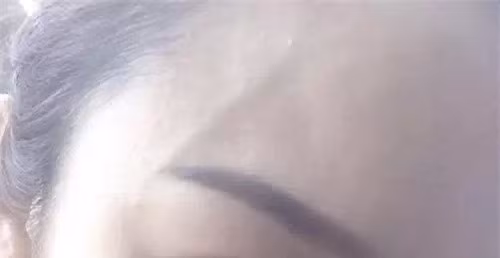 Phụ nữ chớ nên coi thường việc nổi gân xanh trên cơ thể, nhất là trên chân - Ảnh 2. Phụ nữ chớ nên coi thường việc nổi gân xanh trên cơ thể, nhất là trên chân - Ảnh 2.