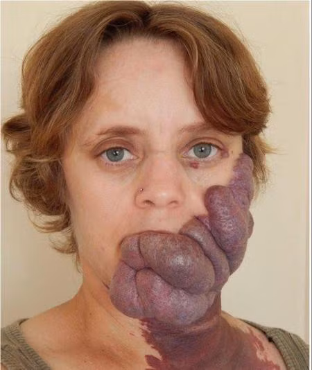 Kiana Smith có một gương mặt đáng sợ nhưng cũng rất đáng thương