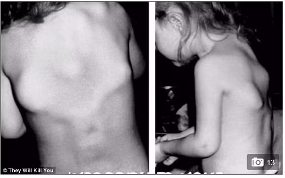 10 căn bệnh đáng sợ nhất trên thế giới 10