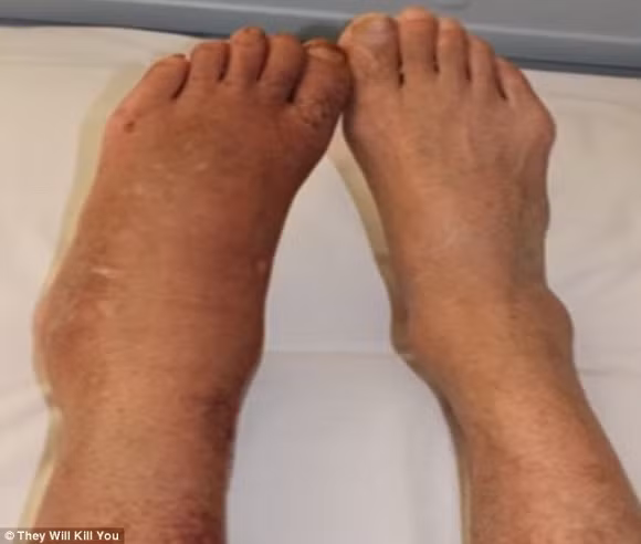 10 căn bệnh đáng sợ nhất trên thế giới 1