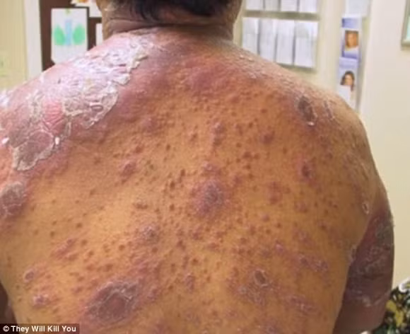 10 căn bệnh đáng sợ nhất trên thế giới 0