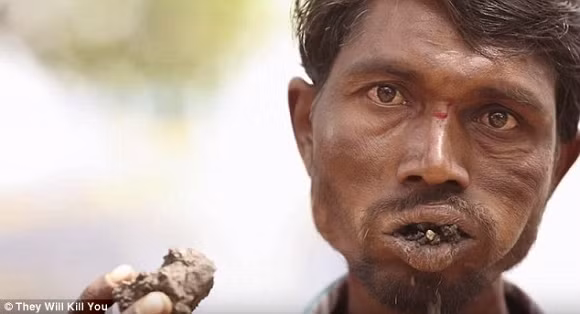 10 căn bệnh đáng sợ nhất trên thế giới 8