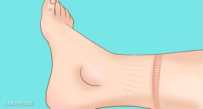 8 dấu hiệu cảnh báo tim của bạn đang có vấn đề ảnh 6 8 dấu hiệu cảnh báo tim của bạn đang có vấn đề