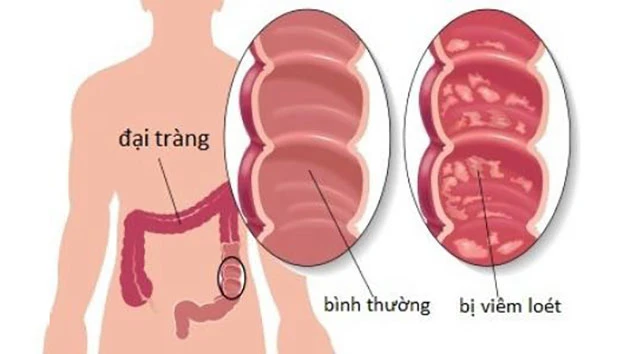 Tác dụng chữa bệnh từ mật động vật