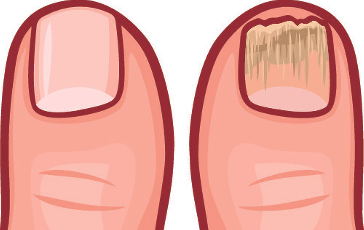 8 dau hieu canh bao co the ban toan doc to hinh anh 7